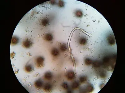 Scleroderma areolatum 87580113