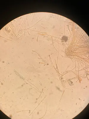 Anthracobia melaloma 118438756