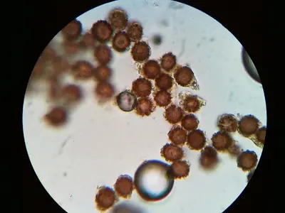 Scleroderma areolatum 87580088