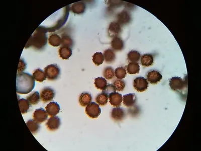 Scleroderma areolatum 87580082