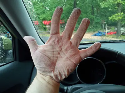 Wrinkled hands following tubing adventure (50857150827)
